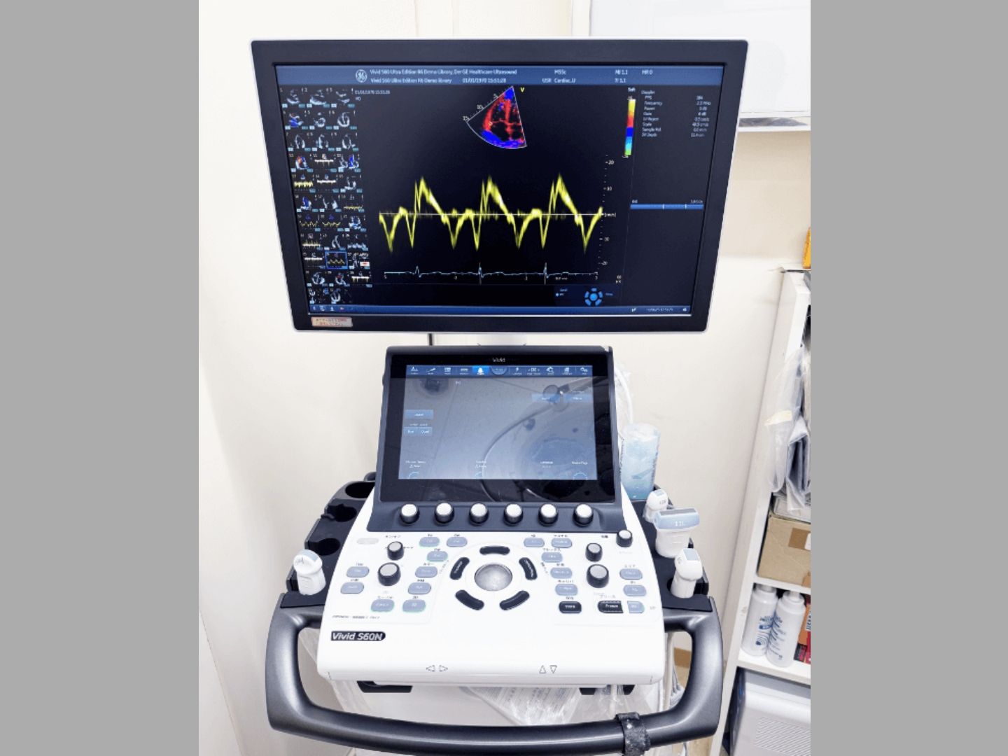 超音波診断装置